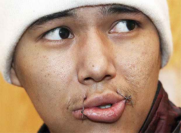 Um prisioneiro em greve de fome exibe a boca costurada  (REUTERS/Vladimir Pirogov)