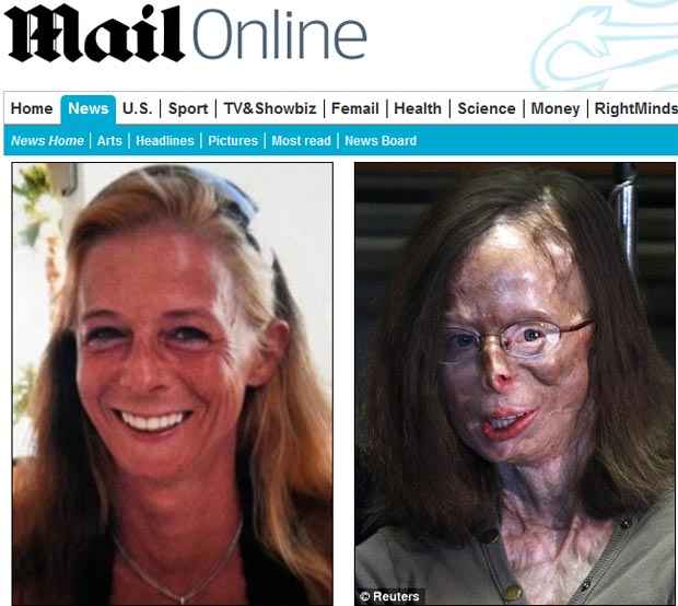 Patricia Lefranc antes do ataque e durante o julgamento de Richard Remes em Bruxelas (Reprodução / www.dailymail.co.uk/news/article-2113939/Patricia-Lefranc-Acid-attack-victim-arrives-testify-married-lover.html) Patricia Lefranc antes do ataque e durante o julgamento de Richard Remes em Bruxelas (Reprodução / www.dailymail.co.uk/news/article-2113939/Patricia-Lefranc-Acid-attack-victim-arrives-testify-married-lover.html)