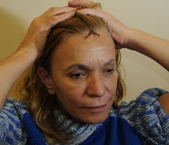 Empresária levou pontos e foi algemada com a filha (Marcos Vieira/EM/D.A Press) Empresária levou pontos e foi algemada com a filha (Marcos Vieira/EM/D.A Press)