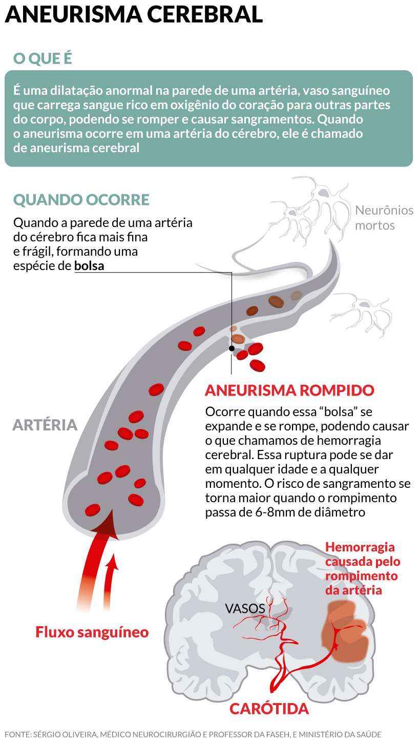 Bomba Relogio Ciencia Estado De Minas