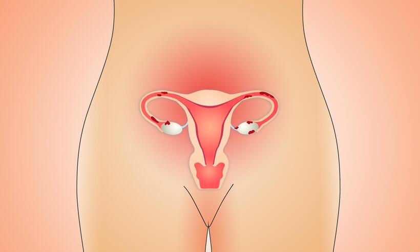 Arquivos Sem categoria - Página 2 de 14 - Centro Avançado em Endometriose